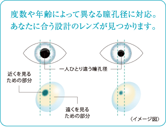 年齢によって変わる瞳孔の大きさ