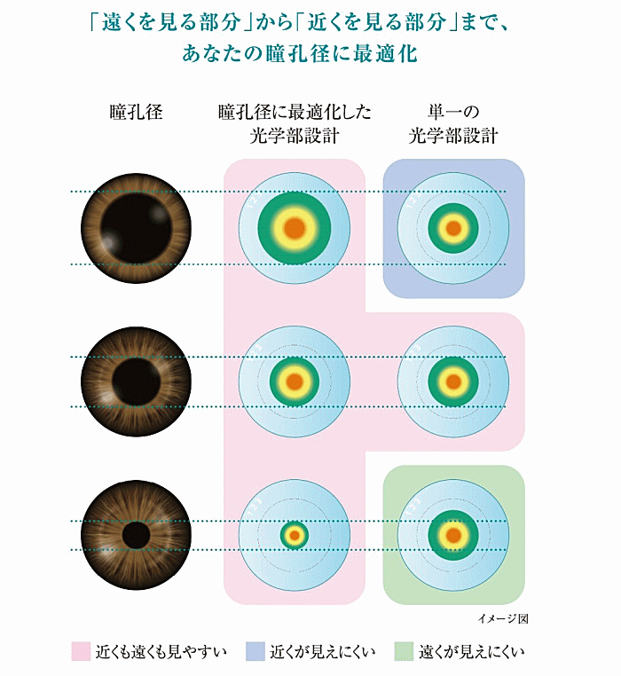アキュビューオアシスマルチフォーカル瞳孔径に最適化