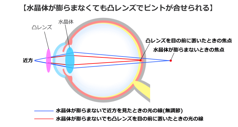 凸レンズで老眼の矯正