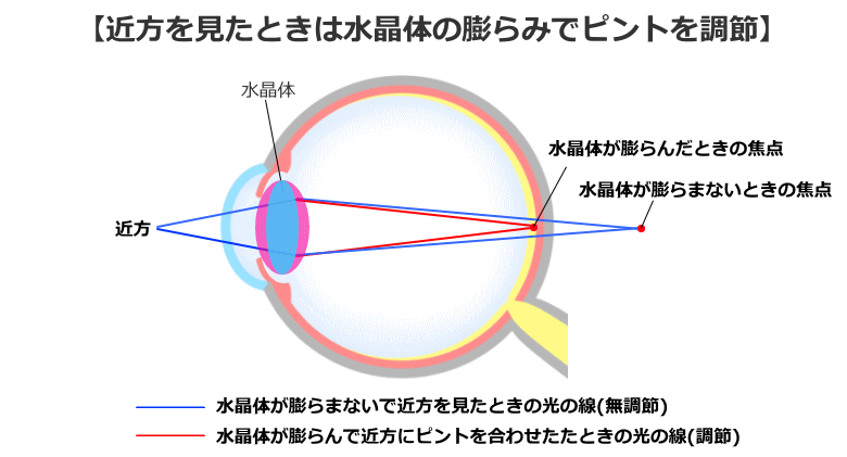 老眼の矯正